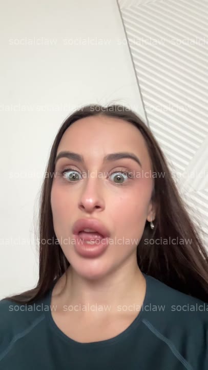wide-eyed hand-over-mouth gasp